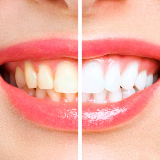 Premium dental service 2